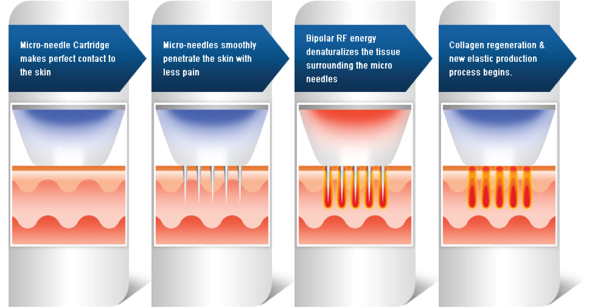 Secret Rf Tag Line Secret RF – Skinnovation